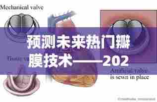 2024年热门瓣膜技术预测,选择与应用的步骤指南
