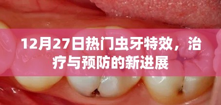 12月热门虫牙特效,治疗与预防最新进展